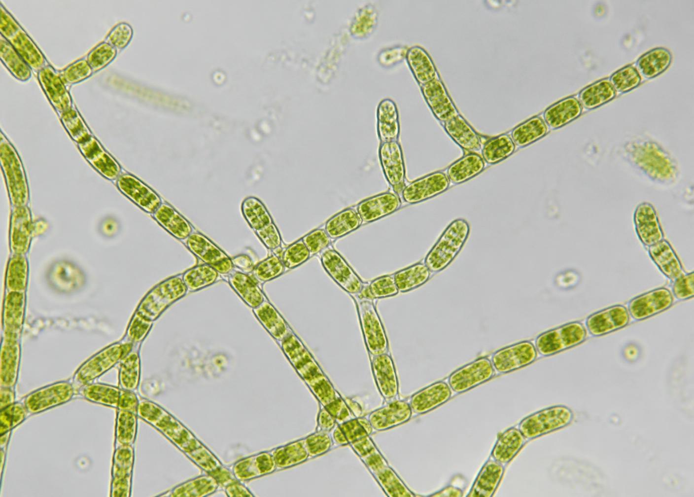 Micrografía de filamentos de protonema de musgo